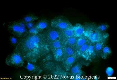 Immunocytochemistry/ Immunofluorescence: CD68/SR-D1 Antibody (KP1) - BSA Free [NB100-683]