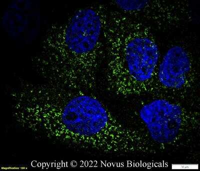 Immunocytochemistry/ Immunofluorescence: CD68/SR-D1 Antibody (KP1) - BSA Free [NB100-683]