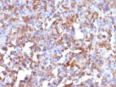 Immunohistochemistry-Paraffin: CD68/SR-D1 Antibody (LAMP4/824) - IHC-Prediluted [NBP2-48024]