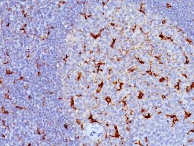 Immunohistochemistry-Paraffin: CD68/SR-D1 Antibody (LAMP4/824) [NBP2-44543]