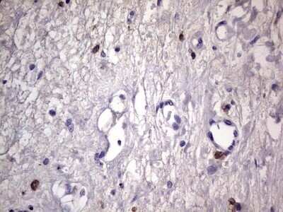 Immunohistochemistry: CD68/SR-D1 Antibody (OTI1E6) - Azide and BSA Free [NBP2-70381]