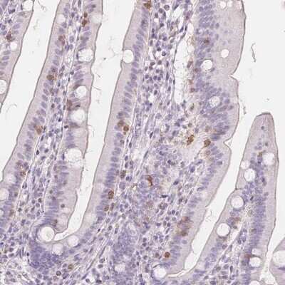 Immunohistochemistry-Paraffin: CD69 Antibody [NBP2-37926]