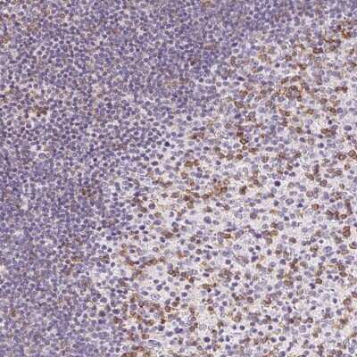 Immunohistochemistry-Paraffin: CD69 Antibody [NBP2-37926]