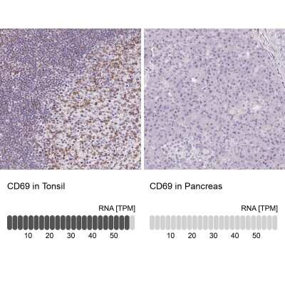 Immunohistochemistry-Paraffin: CD69 Antibody [NBP2-37926]