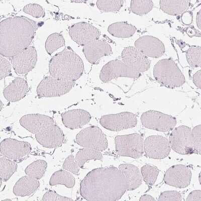 Immunohistochemistry-Paraffin: CD69 Antibody [NBP2-37926]