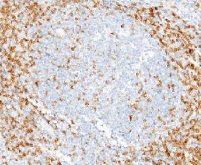 Immunohistochemistry-Paraffin: CD7 Antibody (15) [NBP2-89748]