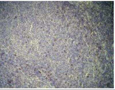 Immunohistochemistry-Paraffin: CD7 Antibody (C21-Q) [NBP1-79080]