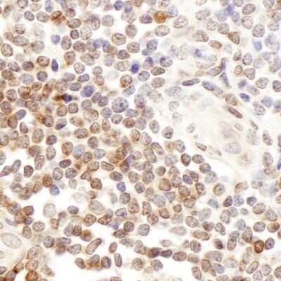 Immunohistochemistry: CD7 Antibody [NBP2-32097]