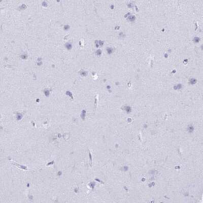 Immunohistochemistry-Paraffin: CD7 Antibody [NBP2-38440]