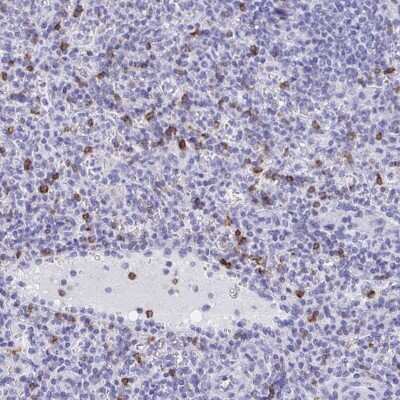 Immunohistochemistry-Paraffin: CD7 Antibody [NBP2-38440]