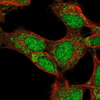 Immunocytochemistry/ Immunofluorescence: CD72 Antibody [NBP2-38533]