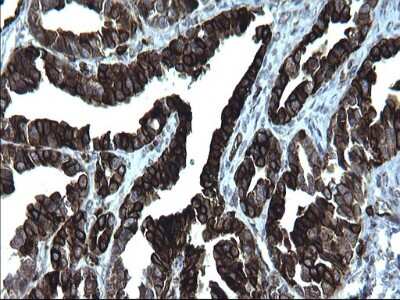 Immunohistochemistry: CD74 Antibody (OTI1H3) [NBP2-46179]