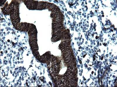 Immunohistochemistry: CD74 Antibody (OTI1H3) [NBP2-46179]
