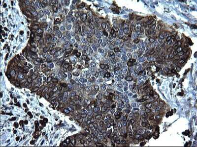 Immunohistochemistry: CD74 Antibody (OTI1H3) [NBP2-46179]