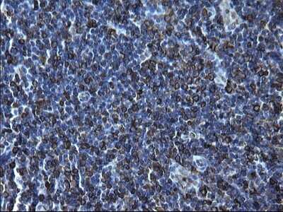 Immunohistochemistry: CD74 Antibody (OTI1H3) [NBP2-46179]