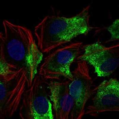 Immunocytochemistry/ Immunofluorescence: CD74 Antibody (2D1B3) - BSA Free [NBP2-37341]