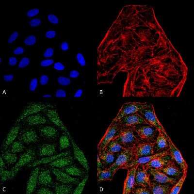 Immunocytochemistry/ Immunofluorescence: CD74 Antibody (6D9) [NBP2-59698]