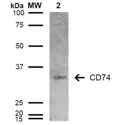 Western Blot: CD74 Antibody (6D9) [NBP2-59698]