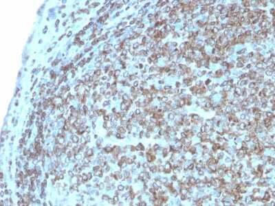Immunohistochemistry-Paraffin: CD74 Antibody (CLIP/3127R) - Azide and BSA Free [NBP3-08927]