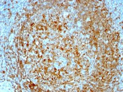 Immunohistochemistry-Paraffin: CD74 Antibody (CLIP/813) [NBP2-44990]