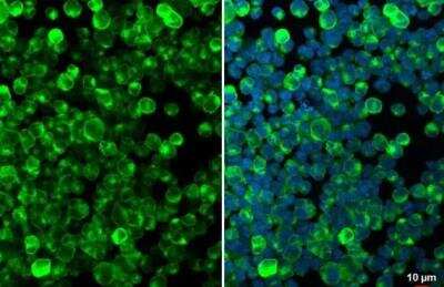 Immunocytochemistry/ Immunofluorescence: CD74 Antibody [NBP1-33109]