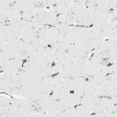 Immunohistochemistry-Paraffin: CD74 Antibody [NBP1-85225]