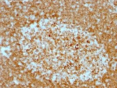 Immunohistochemistry-Paraffin: CD74 Antibody (LN-2 + CLIP/813) [NBP2-44992]
