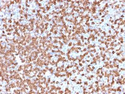 Immunohistochemistry-Paraffin: CD74 Antibody (LN-2) - IHC-Prediluted [NBP2-44988]