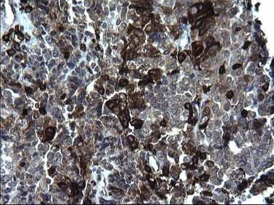Immunohistochemistry: CD74 Antibody (OTI1H3) - Azide and BSA Free [NBP2-70382]