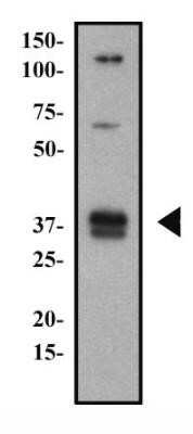 Western Blot: CD74 Antibody (PIN.1)Azide and BSA Free [NBP2-80657]
