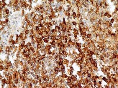 Immunohistochemistry-Paraffin: CD74 Antibody (PIN.1) - BSA Free [NB100-1985]