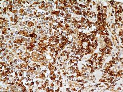 Immunohistochemistry-Paraffin: CD74 Antibody (PIN.1) - BSA Free [NB100-1985]