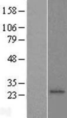 Western Blot: ST6 Gal Sialyltransferase 1/ST6GAL1/CD75 Overexpression Lysate [NBL1-16496]