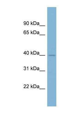 Western Blot: CD77 Synthase Antibody [NBP1-62583]