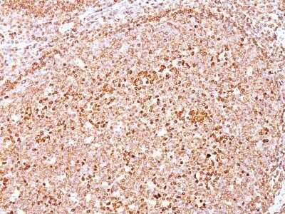 Immunohistochemistry-Paraffin: CD79A Antibody (HM47/A9) - IHC-Prediluted [NBP2-48028]