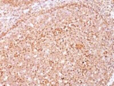 Immunohistochemistry-Paraffin: CD79A Antibody (HM47/A9) - IHC-Prediluted [NBP2-48028]
