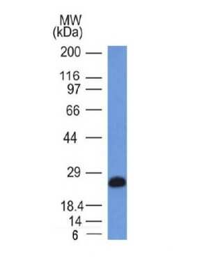Western Blot: CD79A Antibody (IGA/1406) [NBP2-53254]