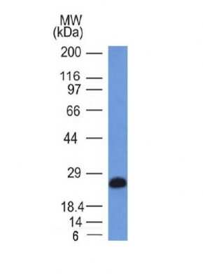 Western Blot: CD79A Antibody (IGA/1406)Azide and BSA Free [NBP2-54370]