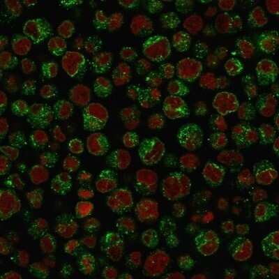 Immunocytochemistry/ Immunofluorescence: CD79A Antibody (IGA/1688R) - Azide and BSA Free [NBP2-54469]