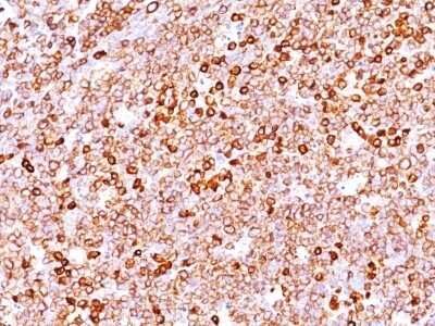 Immunohistochemistry-Paraffin: CD79A Antibody (IGA/1688R) - Azide and BSA Free [NBP2-54469]
