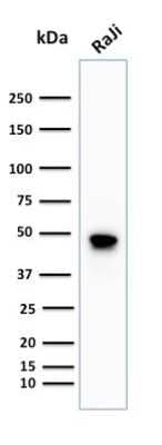 Western Blot: CD79A Antibody (IGA/1688R) [NBP2-53138]