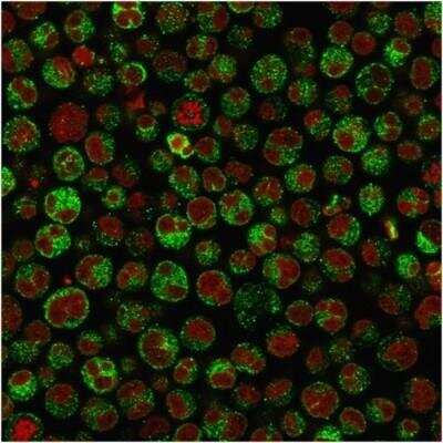 Immunocytochemistry/ Immunofluorescence: CD79A Antibody (IGA/1790R) - Azide and BSA Free [NBP3-11617]