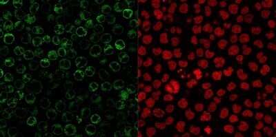 Immunocytochemistry/ Immunofluorescence: CD79A Antibody (JCB117 + HM47/A9) - Azide and BSA Free [NBP2-34653]