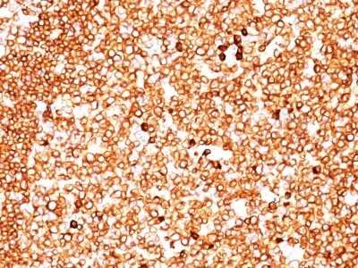 Immunohistochemistry-Paraffin: CD79A Antibody (JCB117 + HM47/A9) - IHC-Prediluted [NBP2-44740]