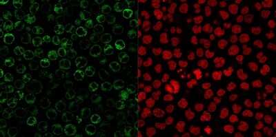 Immunocytochemistry/ Immunofluorescence: CD79A Antibody (JCB117 + HM47/A9) [NBP2-34330]