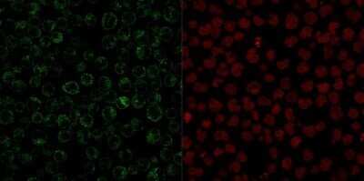 Immunocytochemistry/ Immunofluorescence: CD79A Antibody (JCB117) - Azide and BSA Free [NBP2-34652]