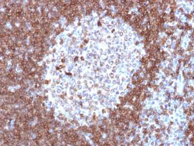 Immunohistochemistry-Paraffin: CD79A Antibody (JCB117) [NBP2-32949]
