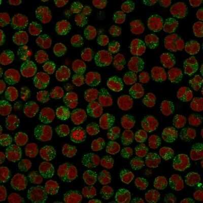 Immunocytochemistry/ Immunofluorescence: CD79A Antibody (SPM549) [NBP2-32833]