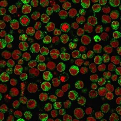 Immunocytochemistry/ Immunofluorescence: CD79A Antibody (SPM550) [NBP2-32834]