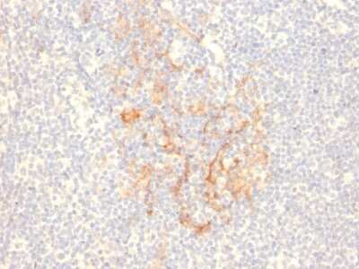 Immunohistochemistry-Paraffin: CD79B Antibody (IGB/2555) - Azide and BSA Free [NBP3-08603]